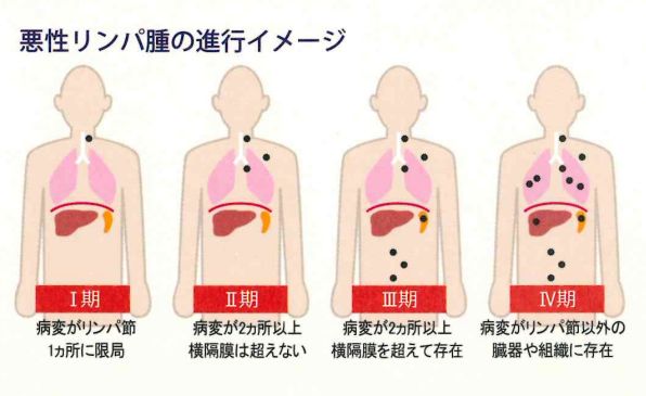 ãæªæ§ãªã³ãè«ãã®ç»åæ¤ç´¢çµæ