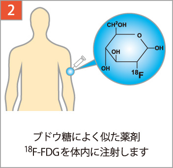 ブドウ糖によく似た薬剤18F-FDGを注射します