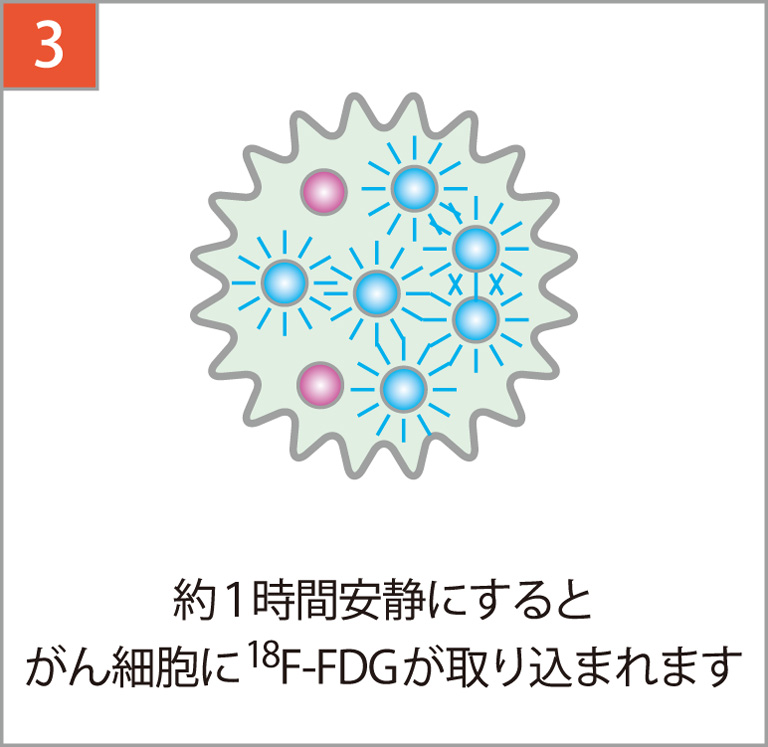 約1時間安静にするとがん細胞に18F-FDGが集まります