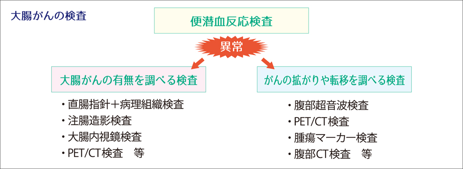 大腸がんの検査