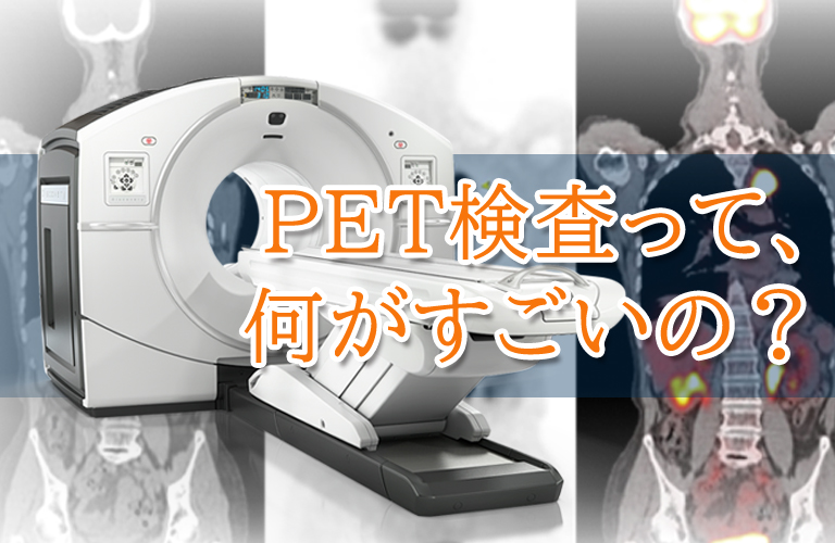 PET検査の何がすごいの？